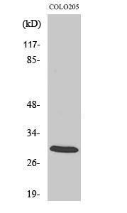 Western blot analysis of COLO205 cells using Anti-14-3-3 zeta Antibody