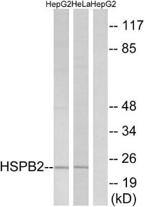 Western blot analysis of lysates from HepG2 and HeLa cells using Anti-HSPB2 Antibody. The right hand lane represents a negative control, where the antibody is blocked by the immunising peptide