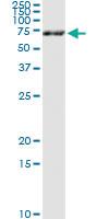 Anti-GLMN Antibody Pair