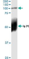 Anti-PLOD2 Rabbit Polyclonal Antibody