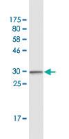 Anti-CCR2 Mouse Monoclonal Antibody [clone: 4D12]