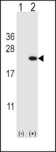 Anti-CFL1 Rabbit Polyclonal Antibody (FITC (Fluorescein Isothiocyanate))