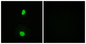 Immunofluorescence analysis of HeLa cells using Anti-TIP60 Antibody The right hand panel represents a negative control, where the antibody was pre-incubated with the immunising peptide