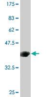 Anti-C4B Mouse Monoclonal Antibody [clone: 1F2]