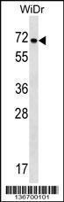 Anti-NOX1 Rabbit Polyclonal Antibody (PE (Phycoerythrin))