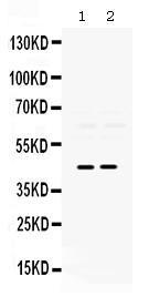 Anti-PAX2 Rabbit Polyclonal Antibody