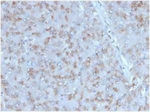 Immunohistochemical analysis of formalin-fixed, paraffin-embedded human adrenal gland tissue using Anti-IL-15 Antibody [IL15/4353]