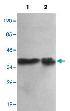 Anti-PPP1CA Mouse Monoclonal Antibody