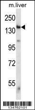 Anti-EIF2AK4 Rabbit Polyclonal Antibody