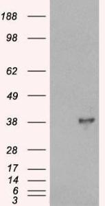 HEK293 overexpressing DOK5 (RC211718) and probed with Anti-DOK5 Antibody (A84044) (mock transfection in first lane), tested by Origene