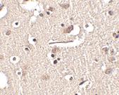 Anti-SLITRK2 Rabbit Polyclonal Antibody