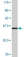 Anti-CLEC4E Mouse Monoclonal Antibody [clone: 2F2]