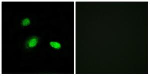 Immunofluorescence analysis of A549 cells using Anti-HSPB2 Antibody. The right hand panel represents a negative control, where the antibody was pre-incubated with the immunising peptide