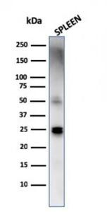 Western blot analysis of human spleen lysate using Anti-TIM3 Antibody [TIM3/4029]