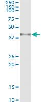 Anti-ARG2 Antibody Pair