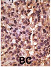 Anti-BNIP3 Rabbit Polyclonal Antibody