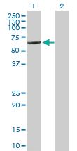 Anti-IFIT1 Rabbit Polyclonal Antibody