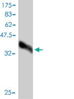 Anti-WFDC2 Mouse Monoclonal Antibody [clone: 3F9]