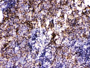 Anti-PAX2 Rabbit Polyclonal Antibody