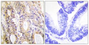 Anti-Smad3 Rabbit Polyclonal Antibody