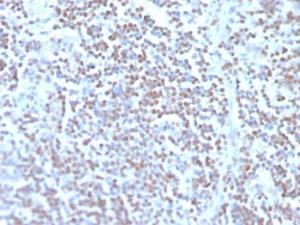 Anti-Cyclin D1 Mouse Recombinant Antibody [clone: rCCND1/4752]