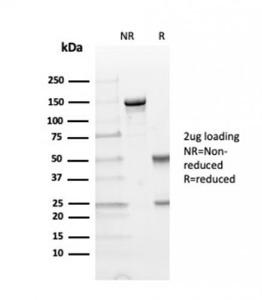 SDS-PAGE analysis of Anti-TIM3 Antibody [TIM3/4029] under non-reduced and reduced conditions; showing intact IgG and intact heavy and light chains, respectively SDS-PAGE analysis confirms the integrity and purity of the antibody