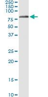 Anti-GLMN Polyclonal Antibody Pair