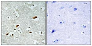 Antibody anti-TIP60 A96991-100 100 µg