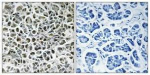 Immunohistochemical analysis of paraffin-embedded human pancreas using Anti-NDUFA3 Antibody 1:100 (4°C overnight). The right hand panel represents a negative control, where the antibody was pre-incubated with the immunising peptide.