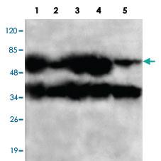 Anti-PPP2CB Mouse Monoclonal Antibody