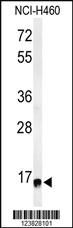 Anti-RPS13 Rabbit Polyclonal Antibody