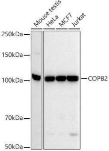 Western blot analysis of extracts of various cell lines, using Anti-COPB2 Antibody [ARC52626] (A305485) at 1:20000 dilution