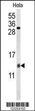 Anti-COX5A Rabbit Polyclonal Antibody