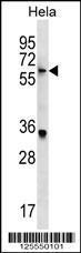 Anti-KLH22 Rabbit Polyclonal Antibody (HRP (Horseradish Peroxidase))