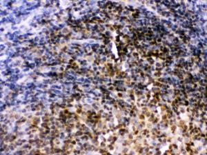 Anti-PAX2 Rabbit Polyclonal Antibody