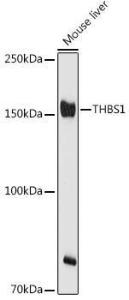 Western blot analysis of extracts of Mouse liver, using Anti-Thrombospondin 1 Antibody (A11512) at 1:500 dilution. The secondary antibody was Goat Anti-Rabbit IgG H&L Antibody (HRP) at 1:10,000 dilution.