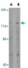 Anti-SLITRK3 Rabbit Polyclonal Antibody