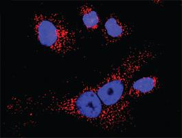 Anti-TWF1 + TWF1 Polyclonal Antibody Pair