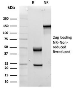 SDS-PAGE analysis of Anti-IL-15 Antibody [IL15/4354] under non-reduced and reduced conditions; showing intact IgG and intact heavy and light chains, respectively. SDS-PAGE analysis confirms the integrity and purity of the antibody.