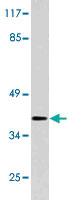 Anti-HFE Rabbit Polyclonal Antibody