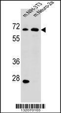 Anti-ME2 Rabbit Polyclonal Antibody