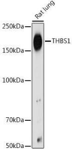 Western blot analysis of extracts of Rat lung, using Anti-Thrombospondin 1 Antibody (A11512) at 1:500 dilution. The secondary antibody was Goat Anti-Rabbit IgG H&L Antibody (HRP) at 1:10,000 dilution.