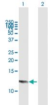 Anti-DEFB103B Mouse Polyclonal Antibody