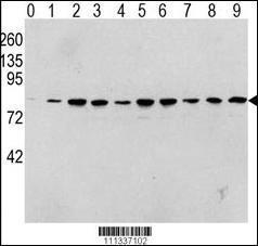 Anti-RAF1 Rabbit Polyclonal Antibody