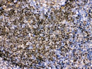 Anti-PAX2 Rabbit Polyclonal Antibody