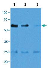 Anti-CASQ2 Mouse Monoclonal Antibody [clone: AT4E10]