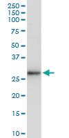 Anti-HLA-DRB5 Polyclonal Antibody Pair