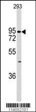 Anti-CDH6 Rabbit Polyclonal Antibody (PE (Phycoerythrin))