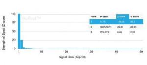 Analysis of protein array containing more than 19,000 full-length human proteins using Anti-IL-15 Antibody [IL15/4354