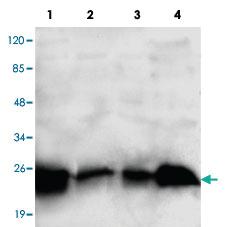 Anti-RAB2A Mouse Monoclonal Antibody